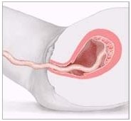 placenta