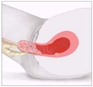 placenta2